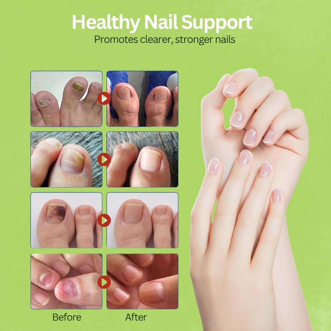 Fungal Nail Patches | FREE 30 Day Full Body Detox Guide eBook