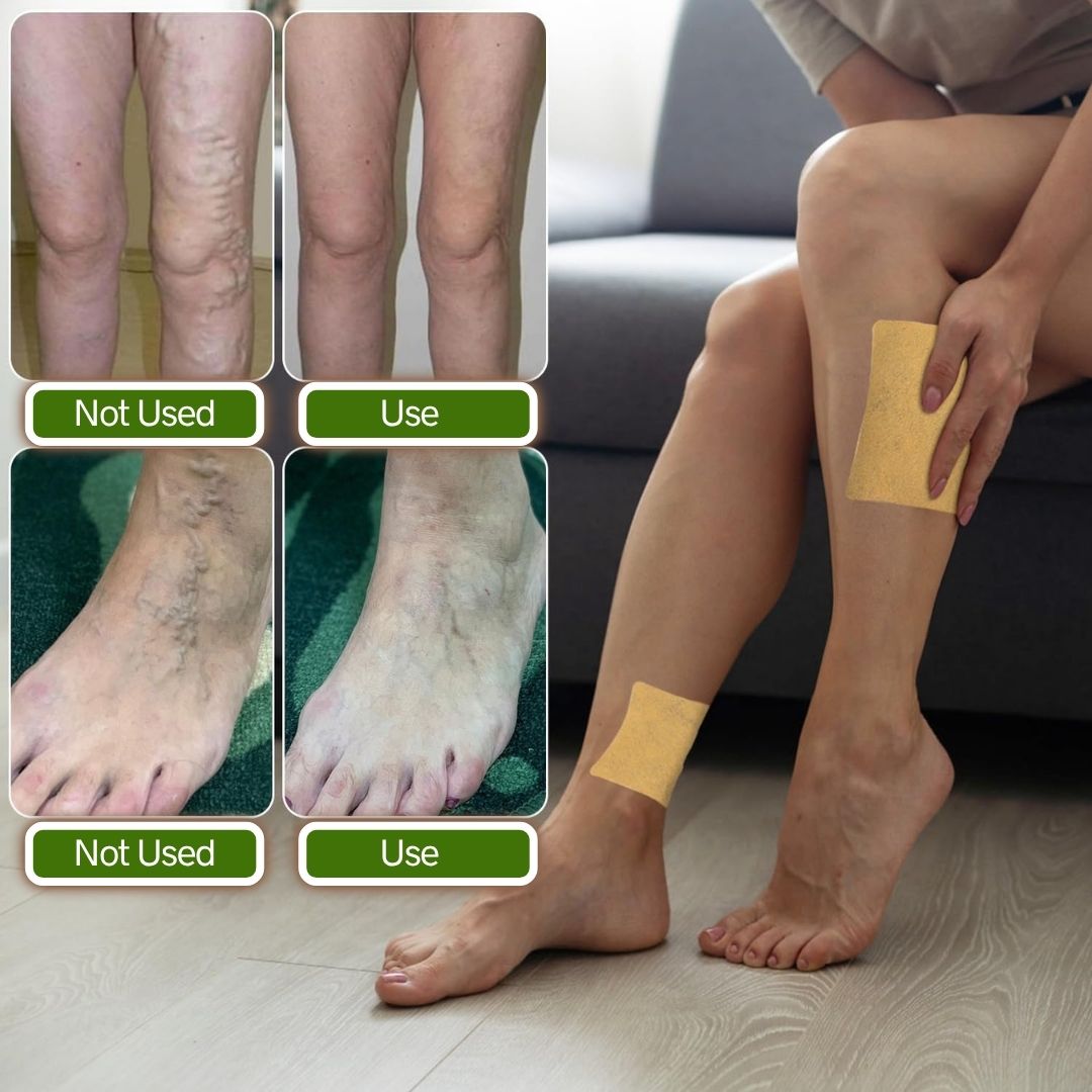 Varicose Veins Patches | FREE 30 Day Full Body Detox Guide eBook