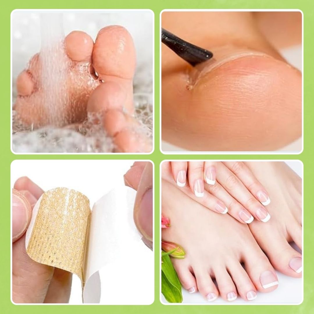 Fungal Nail Patches | FREE 30 Day Full Body Detox Guide eBook